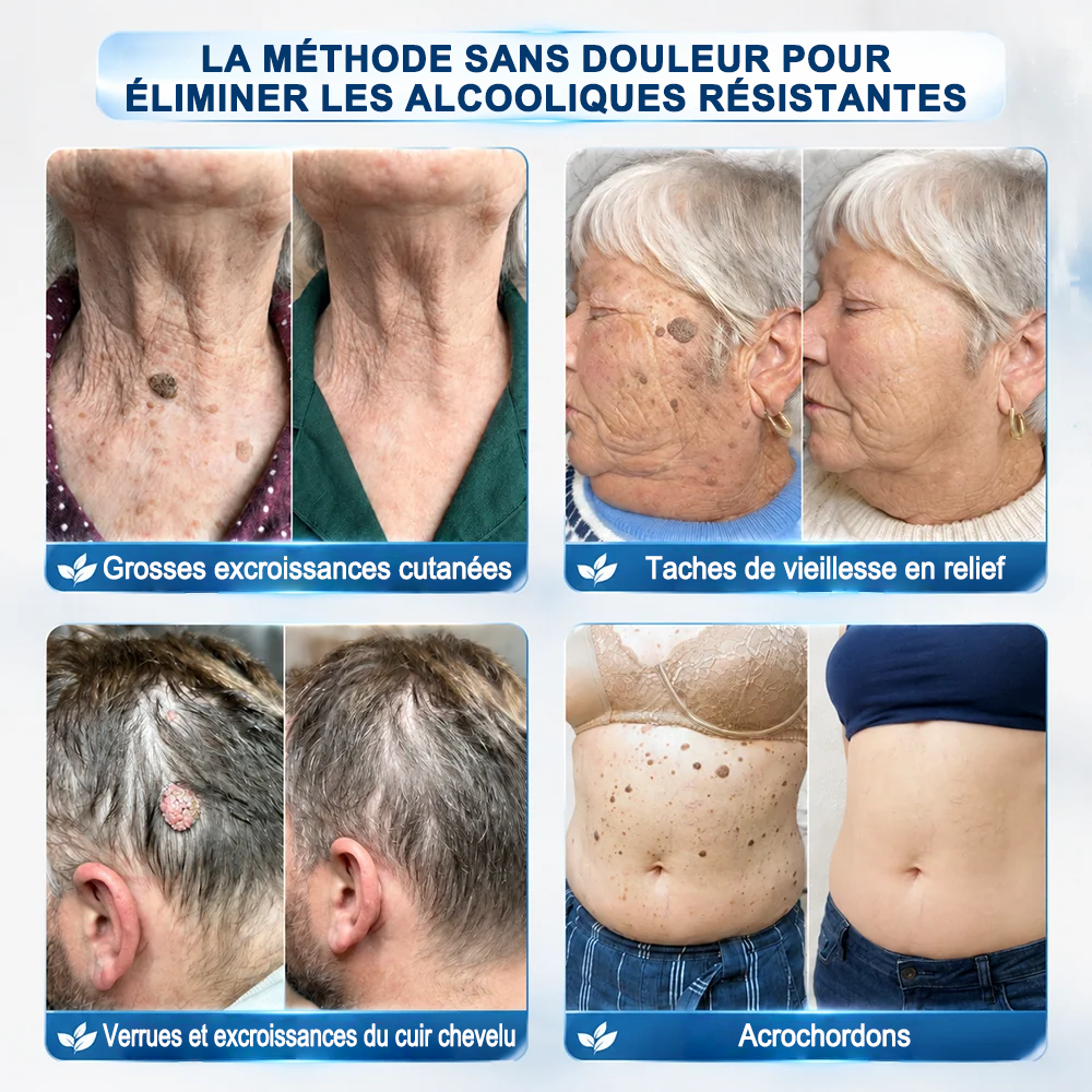 👩‍⚕️✅Purelora® 7 jours, nettoyant visage et parfum pour le visage (sans parfum – sans sels) 👍