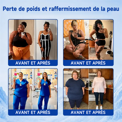 PURELORA® Cryo Sculpt Mist 4-en-1 : technologie adaptative de remodelage par le froid, refroidissement intelligent, protection cutanée et fraîcheur.