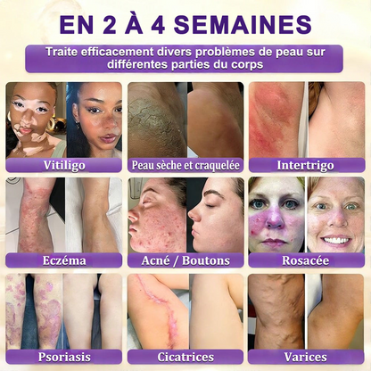 Fabriquée et expédiée depuis la France 🍁 Purelora® Crème réparatrice pour la peau à la biotine 10-en-1 — Dernier jour de promotion : -75 %
