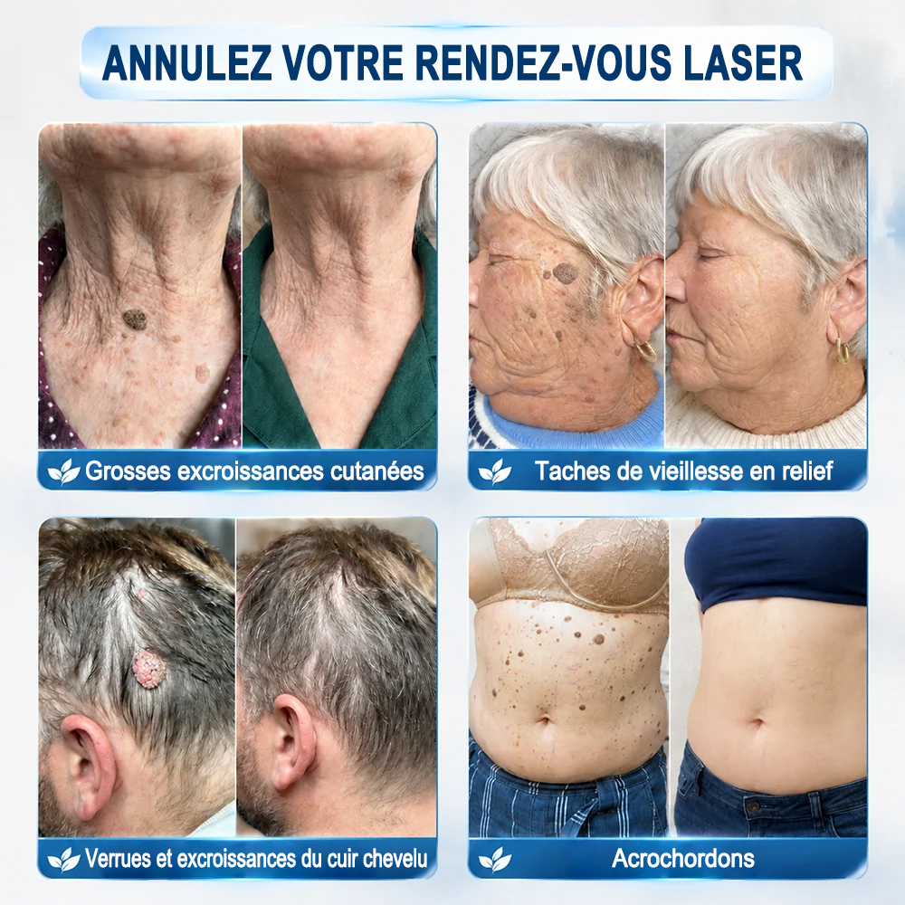 Roll soin hydratant 6 en 1 Purelora® | ✅💎 – Soin anti-acné, contrôle du sébum, atténuation des marques post-imperfections, soin des cicatrices, protection contre les imperfections et soin des pores