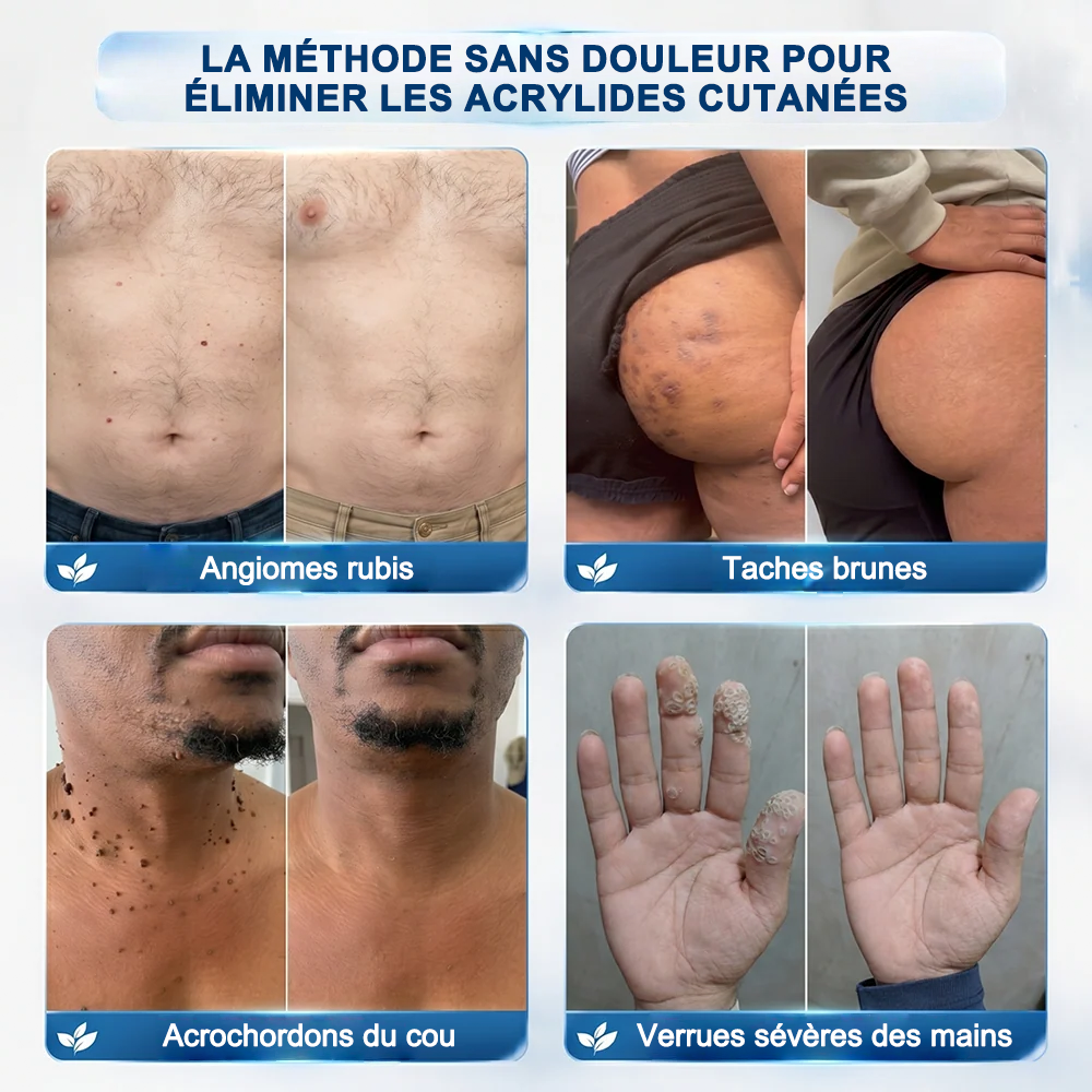 👩‍⚕️✅Purelora® 7 jours, nettoyant visage et parfum pour le visage (sans parfum – sans sels) 👍