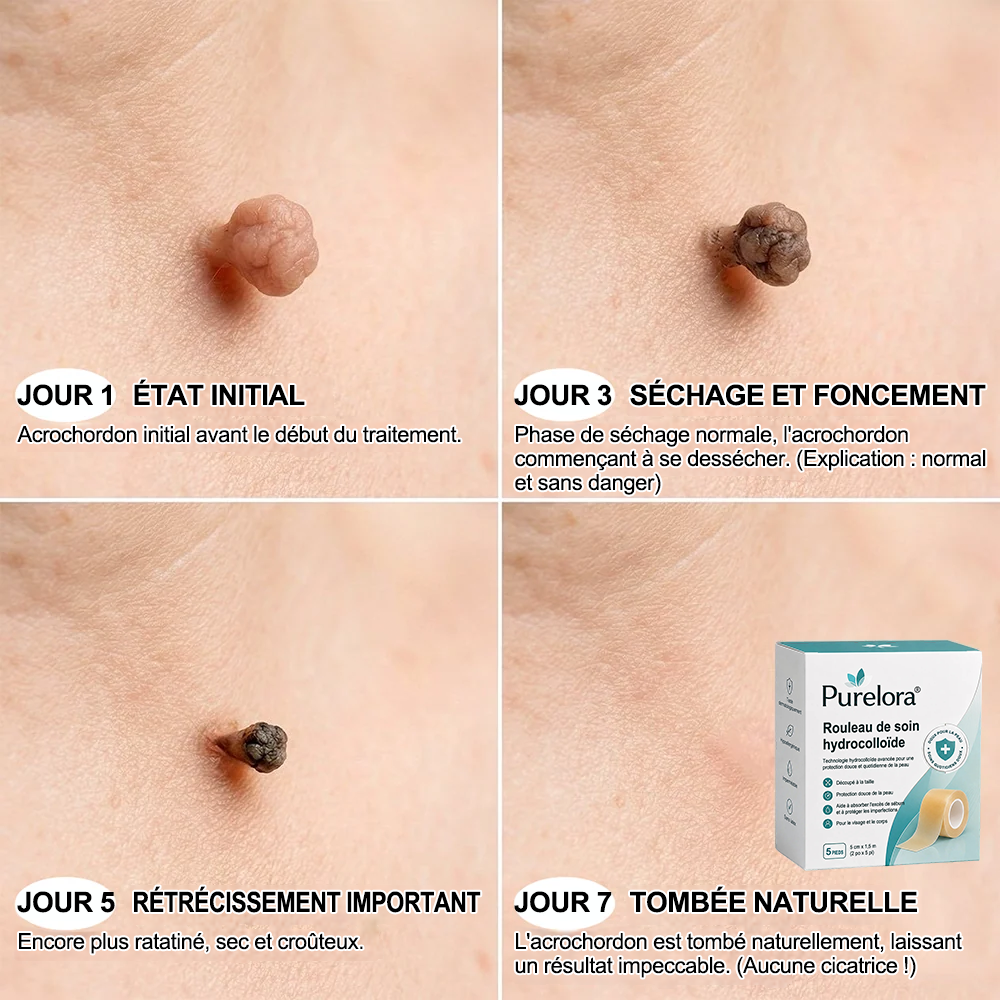 Roll soin hydratant 6 en 1 Purelora® | ✅💎 – Soin anti-acné, contrôle du sébum, atténuation des marques post-imperfections, soin des cicatrices, protection contre les imperfections et soin des pores