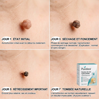 Roll soin hydratant 6 en 1 Purelora® | ✅💎 – Soin anti-acné, contrôle du sébum, atténuation des marques post-imperfections, soin des cicatrices, protection contre les imperfections et soin des pores