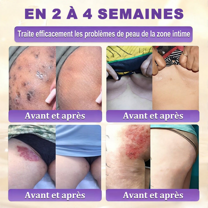 Fabriquée et expédiée depuis la France 🍁 Purelora® Crème réparatrice pour la peau à la biotine 10-en-1 — Dernier jour de promotion : -75 %