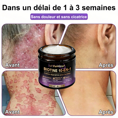 Fabriquée et expédiée depuis la France 🍁 Purelora® Crème réparatrice pour la peau à la biotine 10-en-1 — Dernier jour de promotion : -75 %