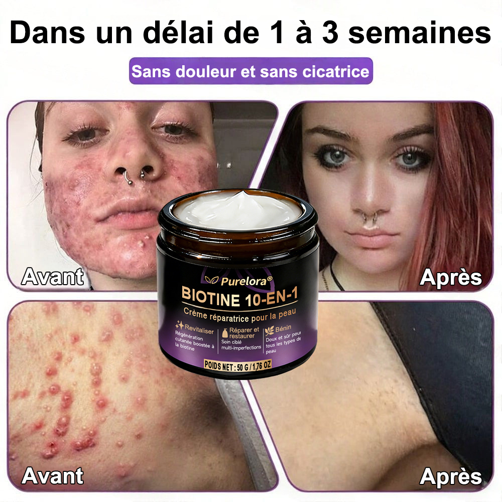 Fabriquée et expédiée depuis la France 🍁 Purelora® Crème réparatrice pour la peau à la biotine 10-en-1 — Dernier jour de promotion : -75 %