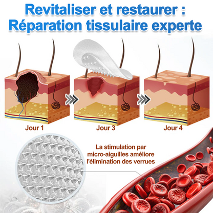 ✨Curalona® Patch micro-aiguilles et hydrocolloïde 2 en 1🍀 | Élimine les grains de beauté en relief, l'acné, les verrues planes et les acrochordons | Atténue les rides, les cicatrices et les imperfections | Patchs invisibles pour le visage et le corps