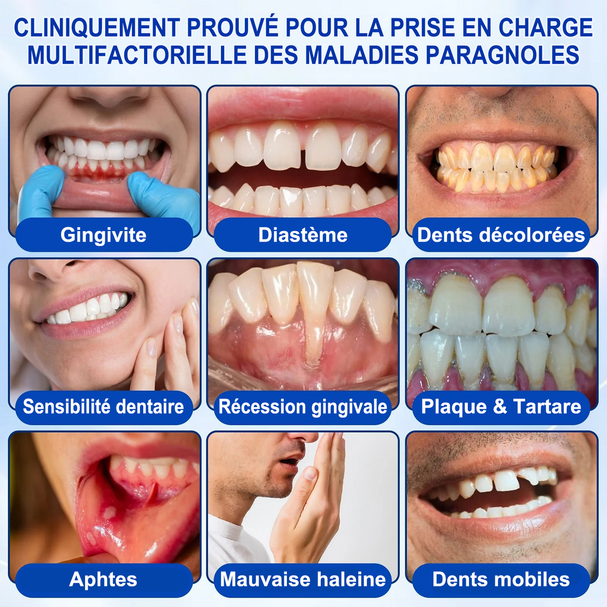 🇫🇷🦷 PURELORA® GumRevive Gel réparateur parodontal (Pour les saignements de gencives, la récession gingivale et les dents mobiles)