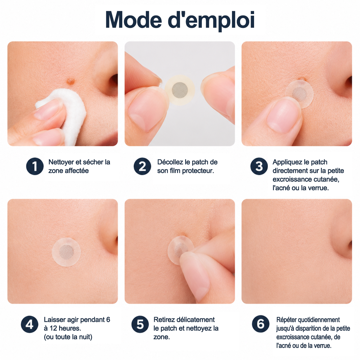 ✨Curalona® Patch micro-aiguilles et hydrocolloïde 2 en 1🍀 | Élimine les grains de beauté en relief, l'acné, les verrues planes et les acrochordons | Atténue les rides, les cicatrices et les imperfections | Patchs invisibles pour le visage et le corps