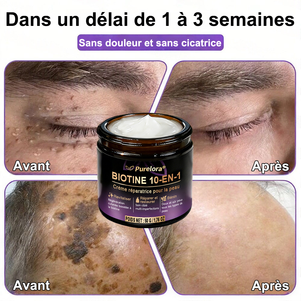 Fabriquée et expédiée depuis la France 🍁 Purelora® Crème réparatrice pour la peau à la biotine 10-en-1 — Dernier jour de promotion : -75 %