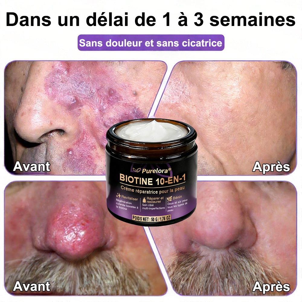 Fabriquée et expédiée depuis la France 🍁 Purelora® Crème réparatrice pour la peau à la biotine 10-en-1 — Dernier jour de promotion : -75 %