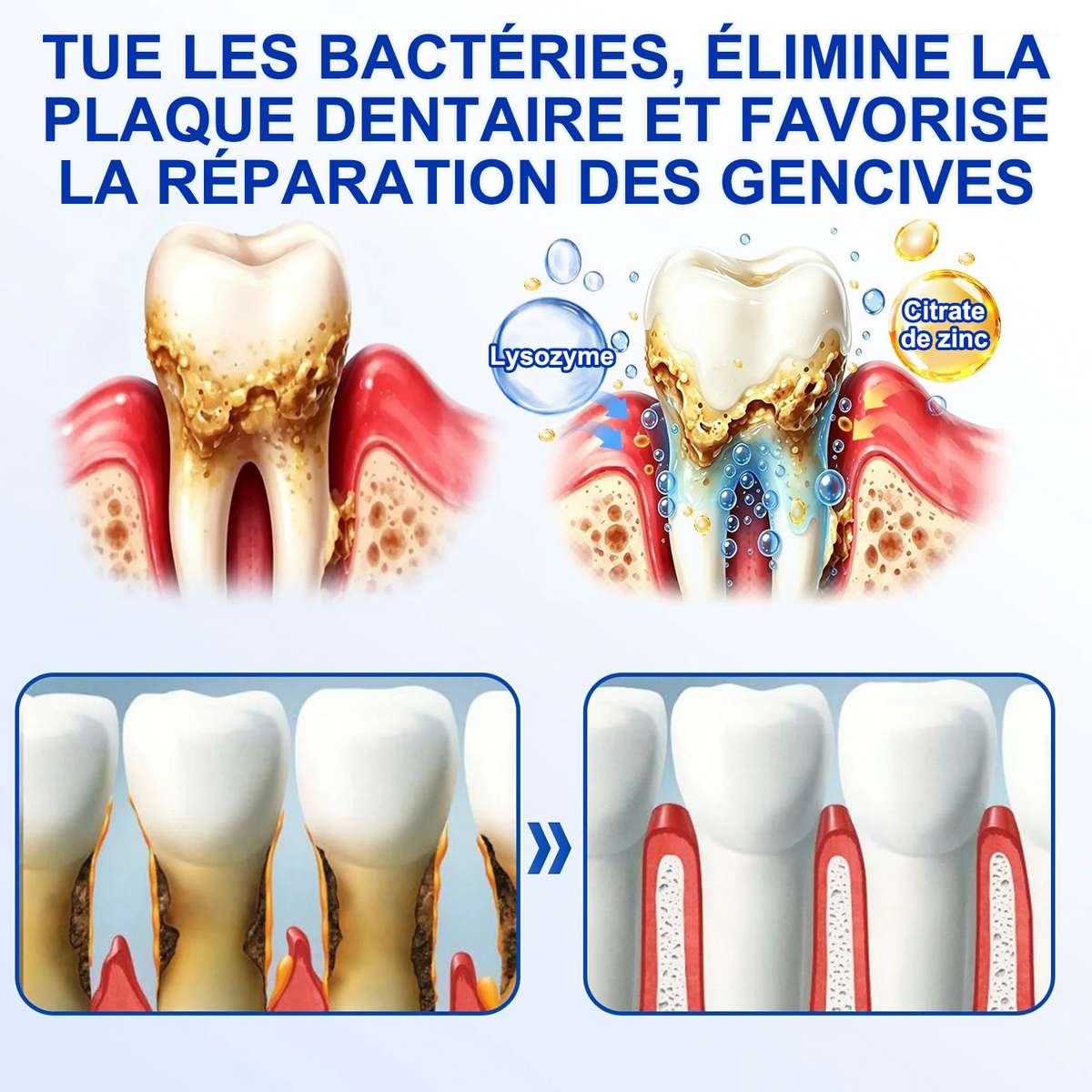 🇫🇷🦷 PURELORA® GumRevive Gel réparateur parodontal (Pour les saignements de gencives, la récession gingivale et les dents mobiles)