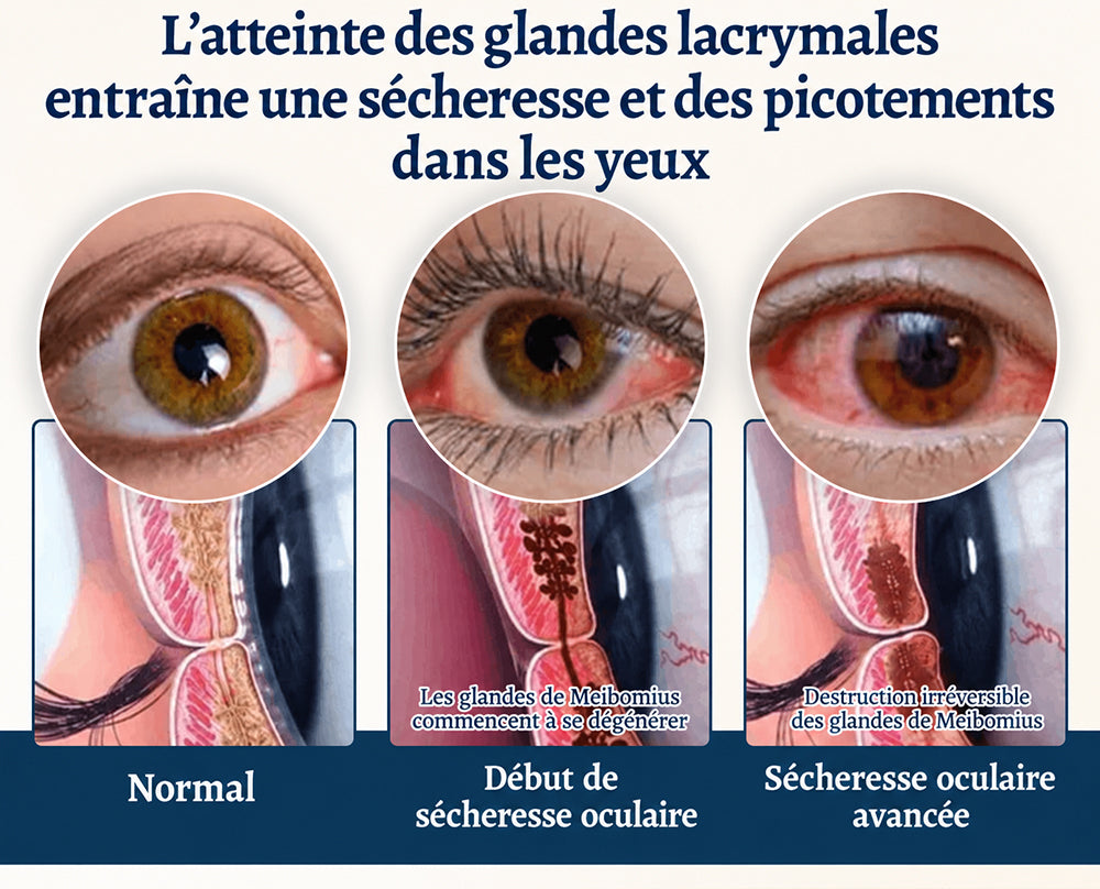 Curalona® Cache-œil OptiFusion Vision Support