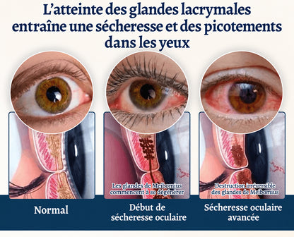Curalona® Cache-œil OptiFusion Vision Support