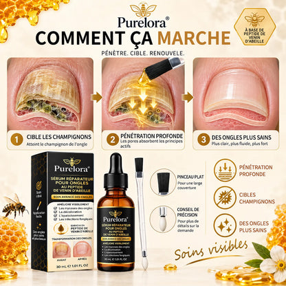 Sérum réparateur pour ongles et pieds Purelora® à base de peptides de venin d'abeille, pour le soin des mycoses des ongles, des ongles jaunes, des ongles épais et le soutien à la récupération du pied d'athlète.