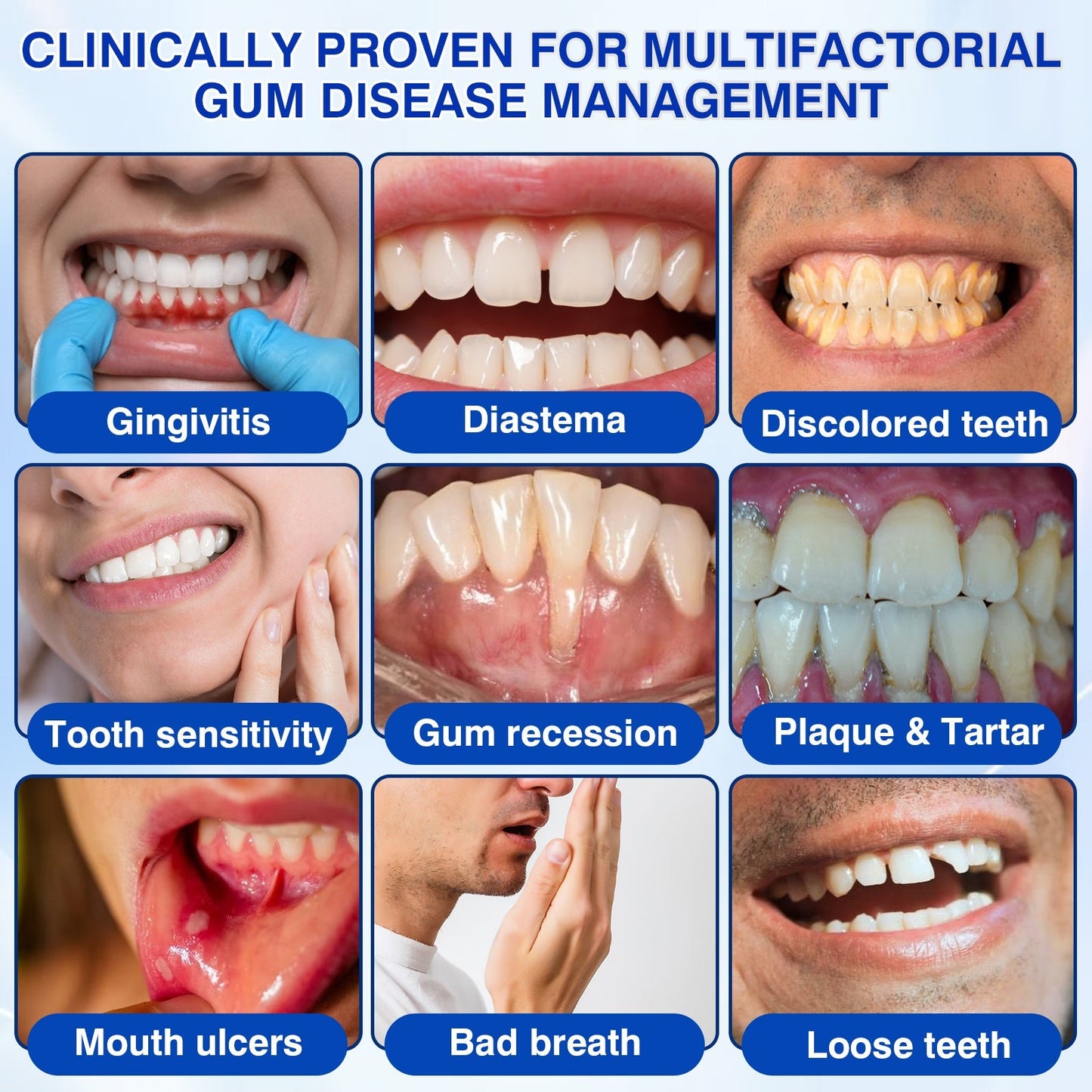 🇺🇸🦷PURELORA® GumRevive Periodontal Repair Gel (For Bleeding Gums, Gum Recession & Loose Teeth)