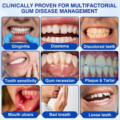 🇺🇸🦷PURELORA® GumRevive Periodontal Repair Gel (For Bleeding Gums, Gum Recession & Loose Teeth)