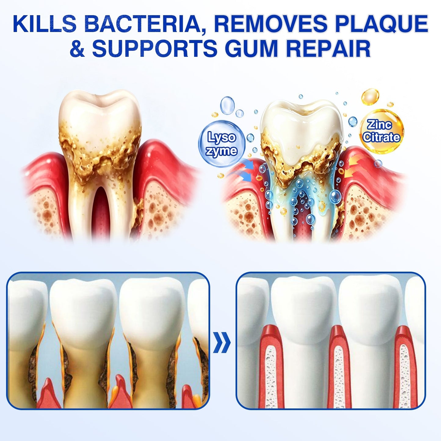 🇺🇸🦷PURELORA® GumRevive Periodontal Repair Gel (For Bleeding Gums, Gum Recession & Loose Teeth)