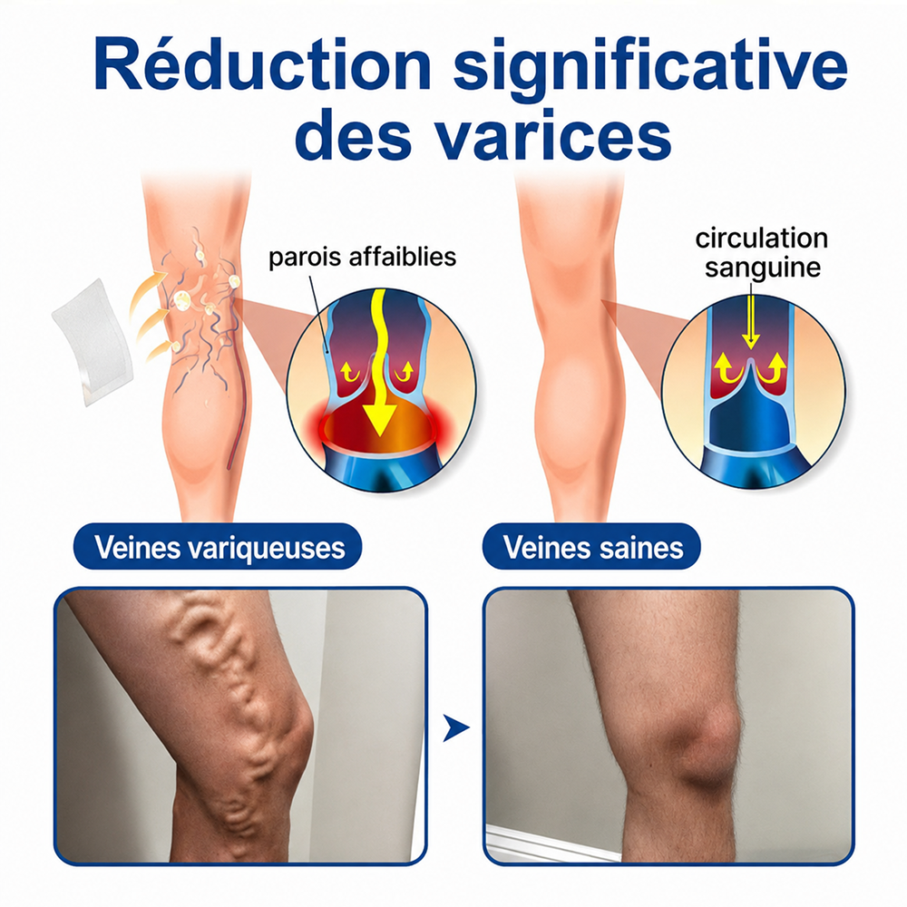 🇫🇷✨👨‍⚕️ CURALONA® VeinTarget Patch à Micro-Aiguilles ⚡ Soulagement rapide, soutien longue durée