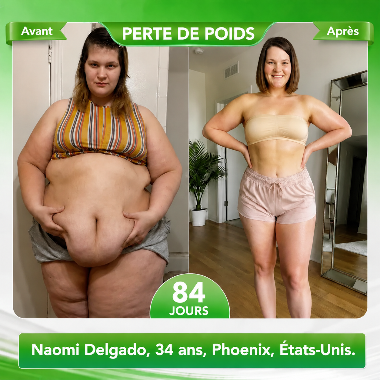 Boutique officielle Curalona® | Patch minceur à nano-aiguilles au phosphore noir Curalona® — Formule 12 en 1 : Berbérine + NMN + Vinaigre de cidre | Favorise la combustion des graisses | Résultats visibles en seulement 7 jours !