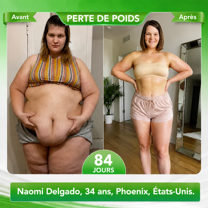 Boutique officielle Curalona® | Patch minceur à nano-aiguilles au phosphore noir Curalona® — Formule 12 en 1 : Berbérine + NMN + Vinaigre de cidre | Favorise la combustion des graisses | Résultats visibles en seulement 7 jours !