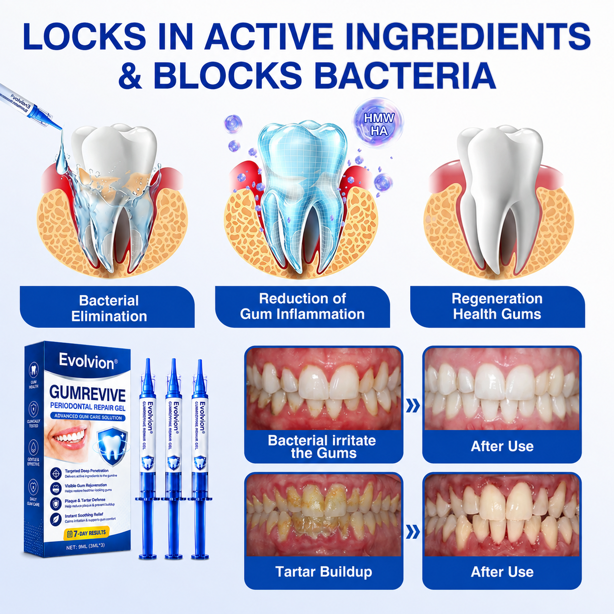 🇺🇸🦷PURELORA® GumRevive Periodontal Repair Gel (For Bleeding Gums, Gum Recession & Loose Teeth)