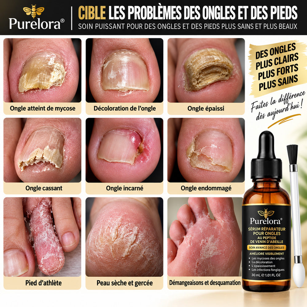Sérum réparateur pour ongles et pieds Purelora® à base de peptides de venin d'abeille, pour le soin des mycoses des ongles, des ongles jaunes, des ongles épais et le soutien à la récupération du pied d'athlète.