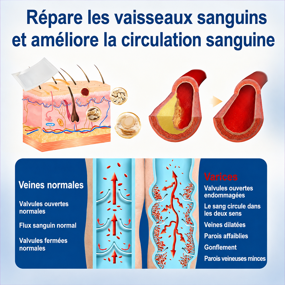 🇫🇷✨👨‍⚕️ CURALONA® VeinTarget Patch à Micro-Aiguilles ⚡ Soulagement rapide, soutien longue durée