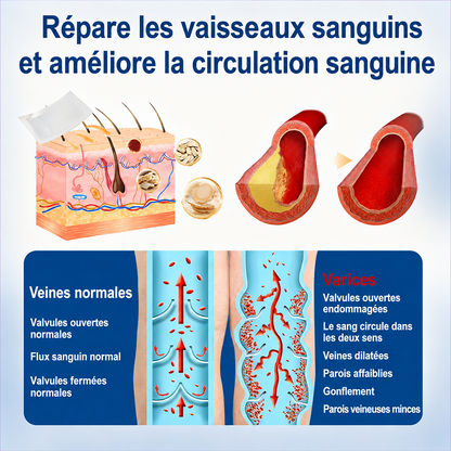 🇫🇷✨👨‍⚕️ CURALONA® VeinTarget Patch à Micro-Aiguilles ⚡ Soulagement rapide, soutien longue durée