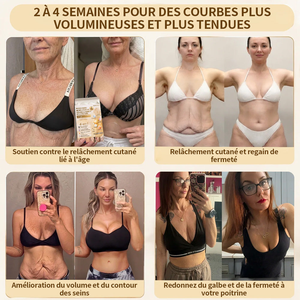 CURALONA®🏆 Patchs de nano-microneedling pour le volume, le galbe et la fermeté du buste – Formule Volufiline + Exosomes + Peptide de cuivre, boostée par la technologie de renouvellement cellulaire.