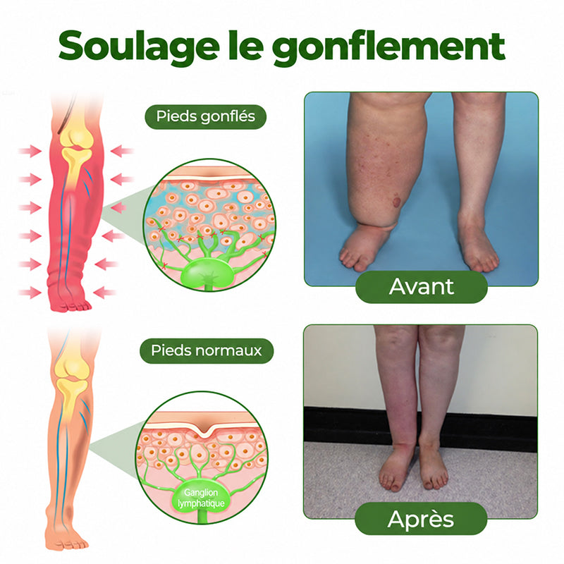 Crème Purelora® Professional pour la circulation des jambes