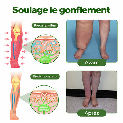 Crème Purelora® Professional pour la circulation des jambes