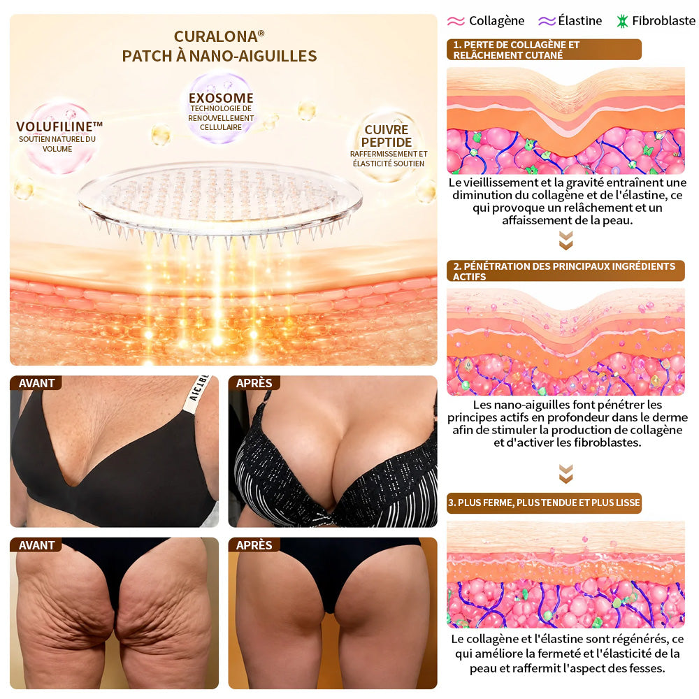CURALONA®🏆 Patchs de nano-microneedling pour le volume, le galbe et la fermeté du buste – Formule Volufiline + Exosomes + Peptide de cuivre, boostée par la technologie de renouvellement cellulaire.