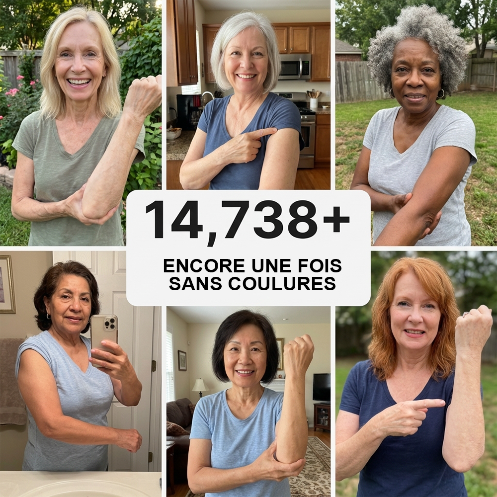 💥Plus de 100 000 unités vendues💕 - Crème PURELORA® pour réparer les ecchymoses et renforcer la peau