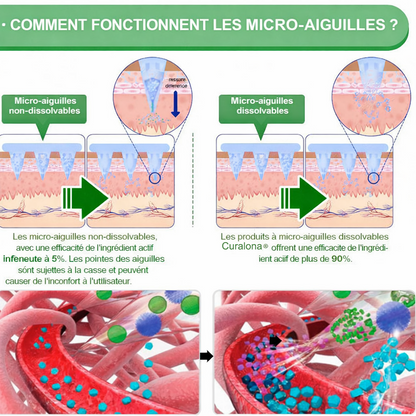 🔥 Parches de Microneedles 10 en 1 Mejorados de Curalona® — Sinergia de Berberina y NAD+ para favorecer la salud metabólica, promover la renovación cutánea y aliviar las molestias articulares — Resultados visibles en 7 días