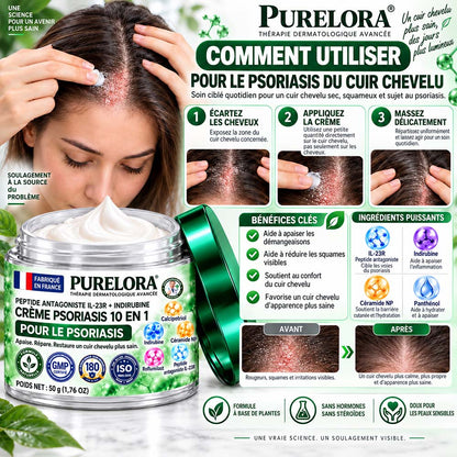 Boutique officielle | 💧 Purelora® Crème 10-en-1 au peptide antagoniste IL-23R + indirubine pour peaux sujettes au psoriasis — aide à réduire rougeurs, squames, sécheresse et démangeaisons et à soutenir la barrière cutanée.