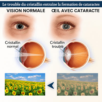 Curalona® Cache-œil OptiFusion Vision Support