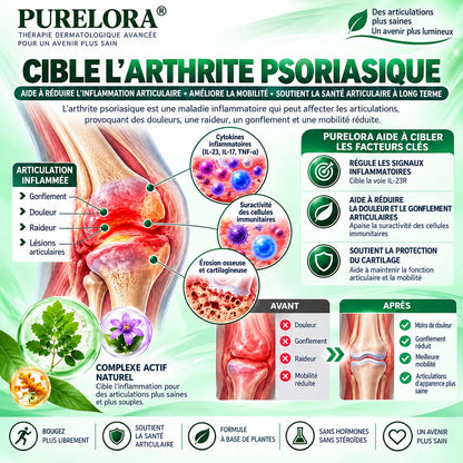 Boutique officielle | 💧 Purelora® Crème 10-en-1 au peptide antagoniste IL-23R + indirubine pour peaux sujettes au psoriasis — aide à réduire rougeurs, squames, sécheresse et démangeaisons et à soutenir la barrière cutanée.