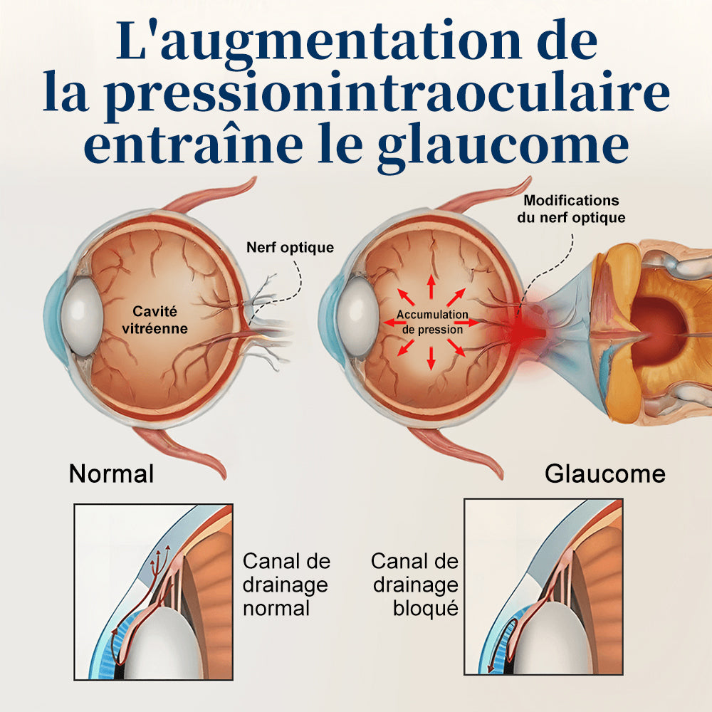 Curalona® Cache-œil OptiFusion Vision Support
