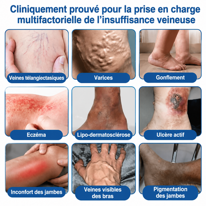 🇫🇷🏆✅️🏃 Patch à micro-aiguilles Curalona® pour le soin ciblé des veines ⚡ Soulagement rapide, résultats durables